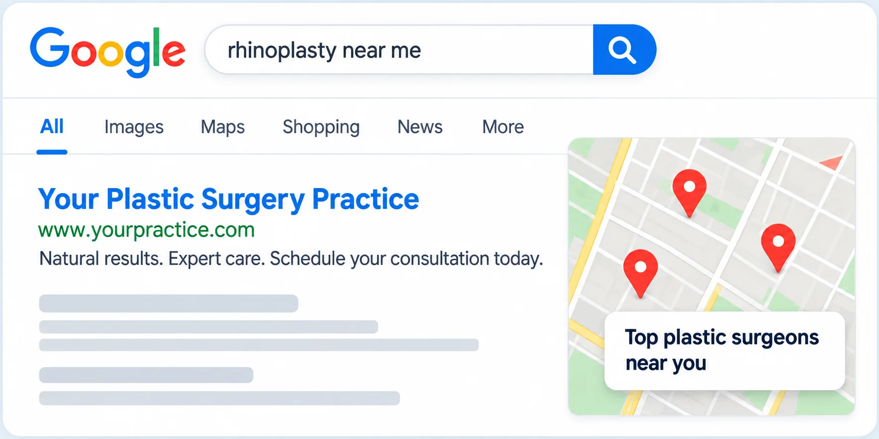 Plastic surgery practice appearing in local search results for rhinoplasty near me